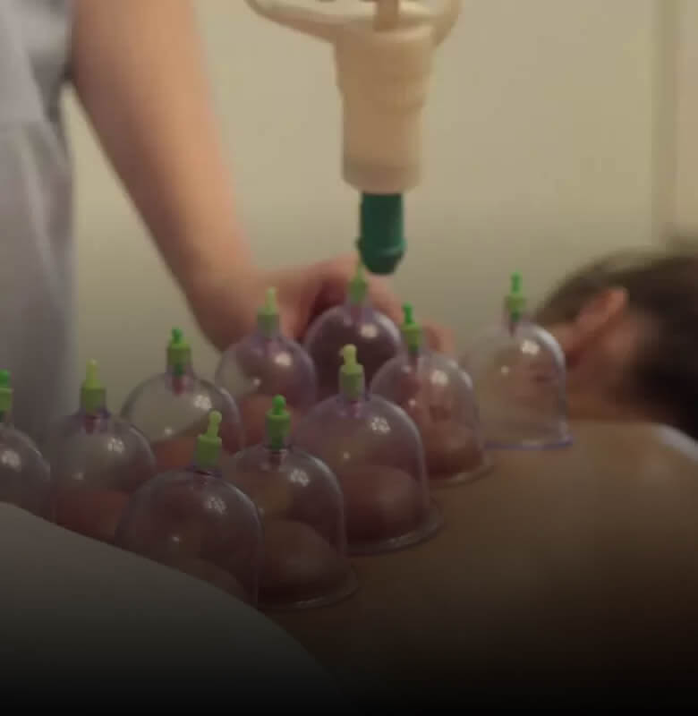 Massagem ventosas